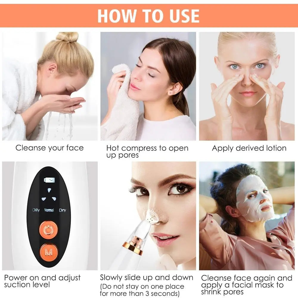 ELECTRIC BLACKHEAD VACUUM CLEANER - BODYHEALTHTODAY