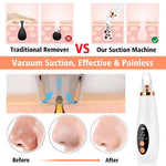 ELECTRIC BLACKHEAD VACUUM CLEANER - BODYHEALTHTODAY